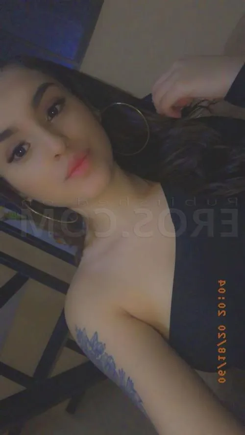 random escort 20