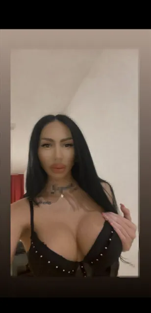 random escort 9